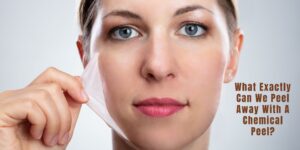 Read more about the article What’s Chemical Peel? Is it Safe for all ages?