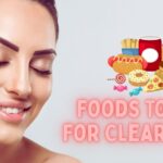 What foods should be avoided to help prevent acne?
