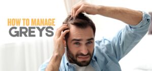 Read more about the article Got my greys! What to do now & how to manage greys?
