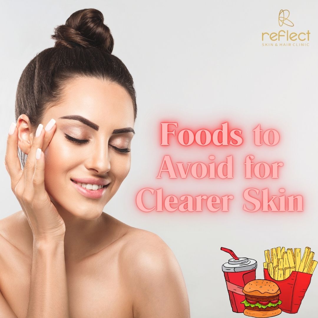 You are currently viewing What foods should be avoided to help prevent acne?