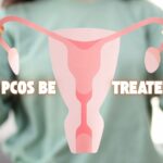 Should PCOS Be Treated? Why am I, a Dermatologist, talking about PCOS?