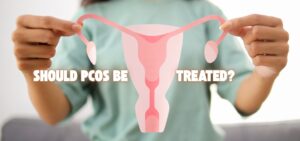 Read more about the article Should PCOS Be Treated? Why am I, a Dermatologist, talking about PCOS?