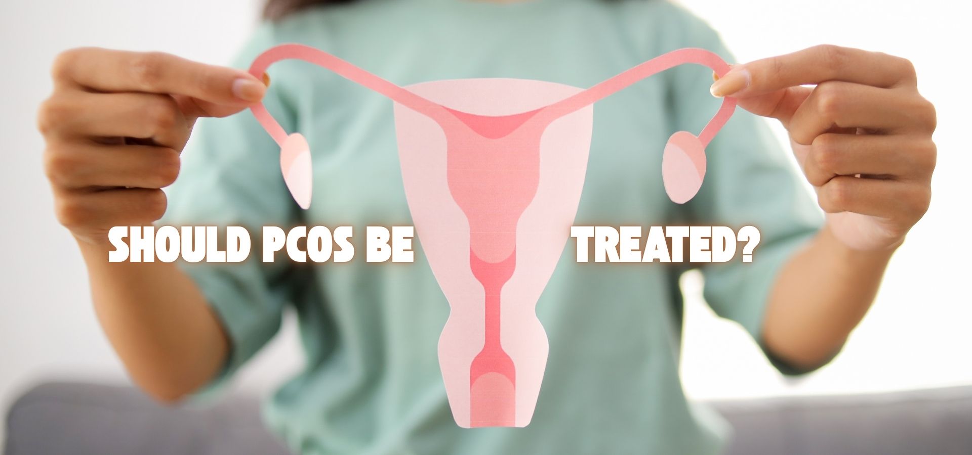 You are currently viewing Should PCOS Be Treated? Why am I, a Dermatologist, talking about PCOS?