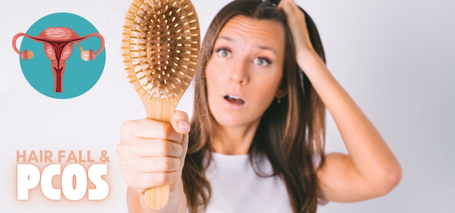 Read more about the article How is Hair fall in PCOS different ?